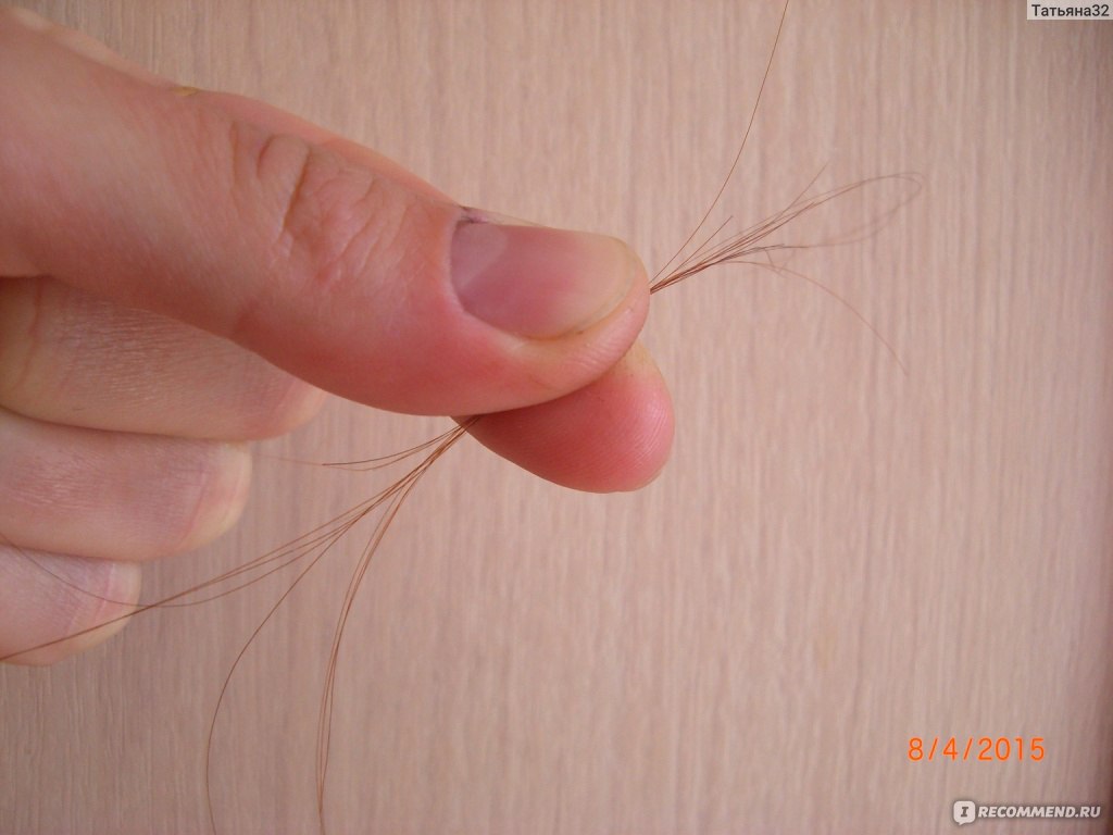 Как выглядит луковица волоса при выпадении фото