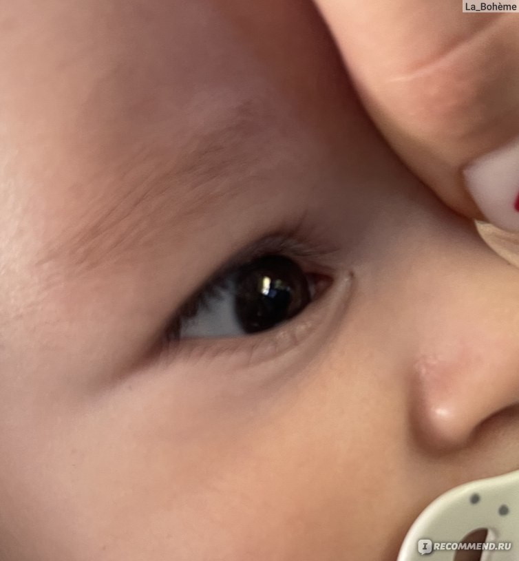 Дакриоцистит капли. Дакриоцистит новорожденных. Зрение у новорожденных. Обработка глаз новорожденного. Дакриоцистит новорожденных массаж.
