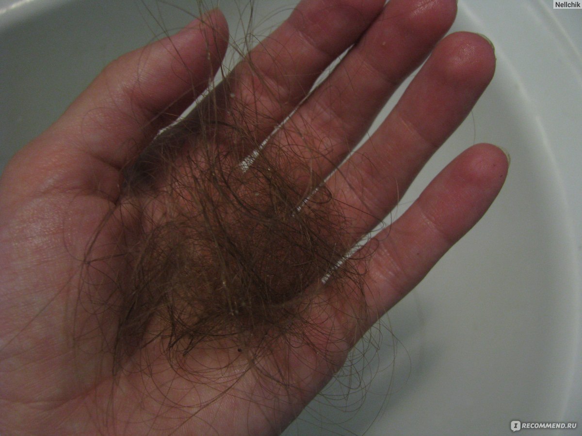 Выпадают волосы после отмены новаринг