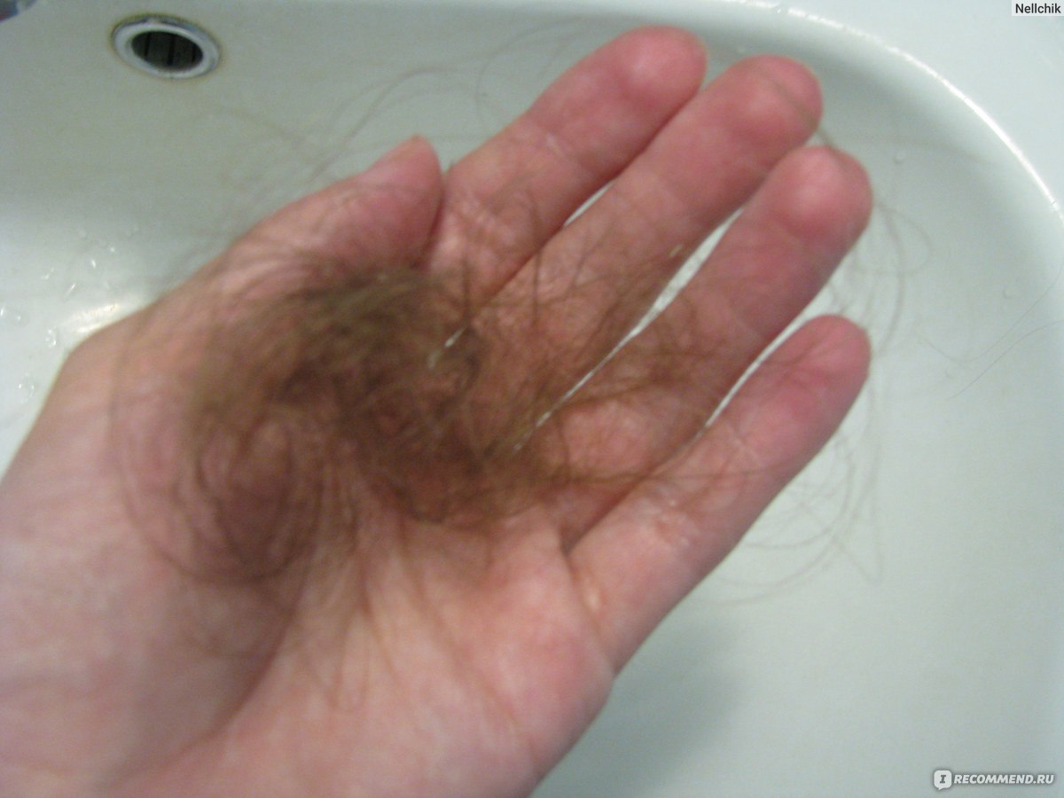 Выпадение волос после родов irecommend