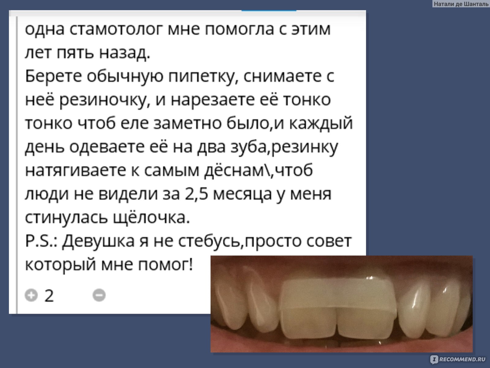 Уход за зубами в домашних условиях - «ОБНОВЛЕНИЕ 2022г ⚠️ Можно ли  соеденить диастему (