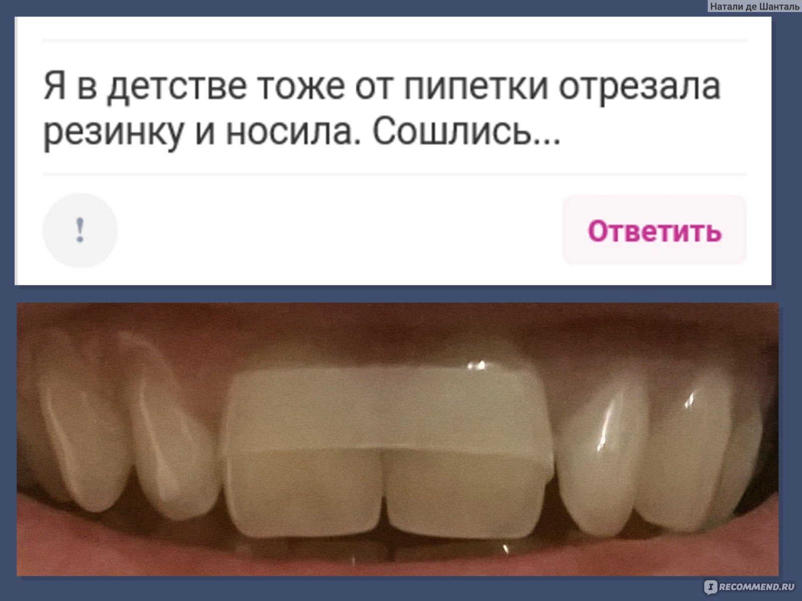 Уход за зубами в домашних условиях - «ОБНОВЛЕНИЕ 2022г ⚠️ Можно ли  соеденить диастему (