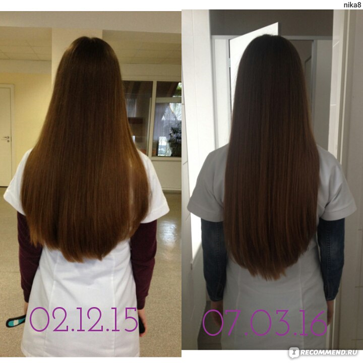 Фото роста волос по месяцам