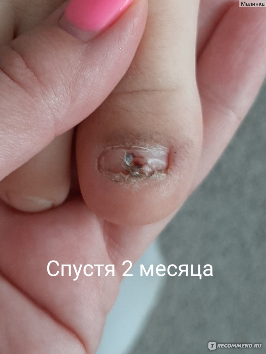 Ушиб пальца у ребенка - признаки, симптомы и лечение в «СМ-Клиника» для детей и подростков