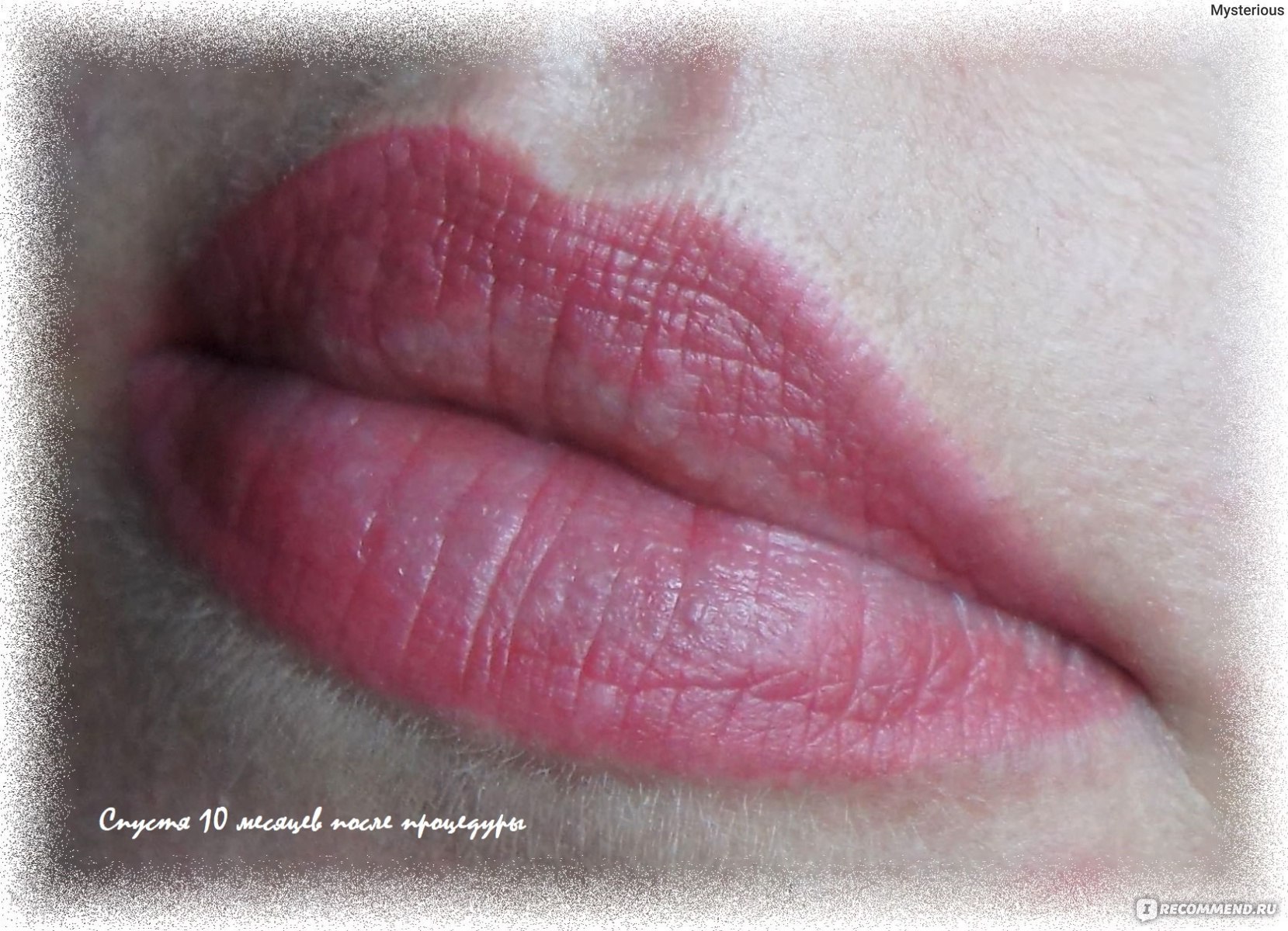 Перманентный макияж губ помадный эффект этапы заживления