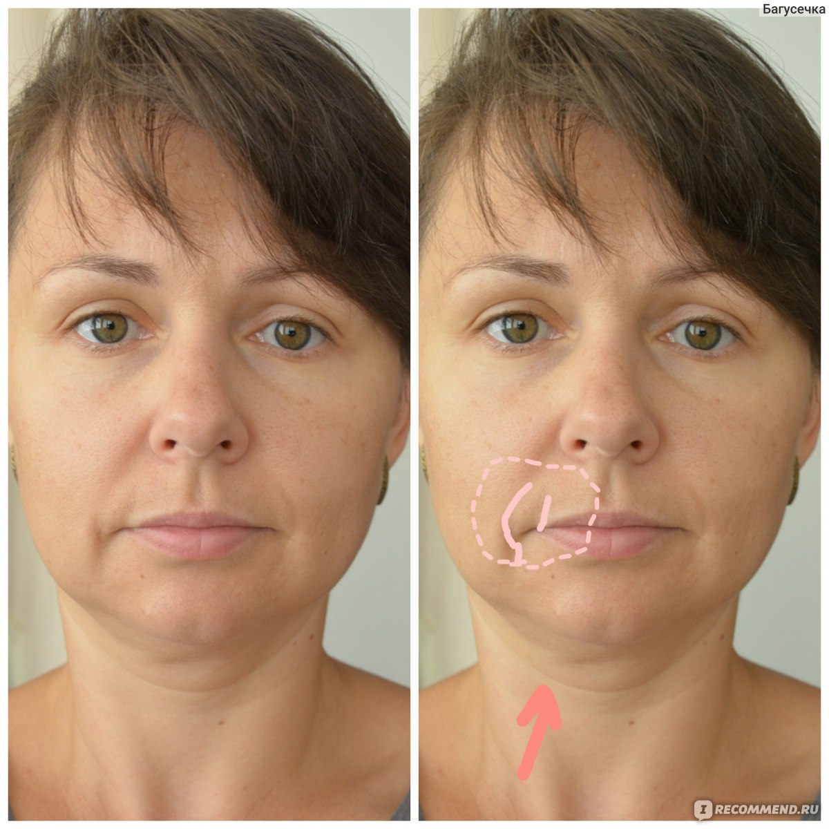 массаж лица фото до и после реальные