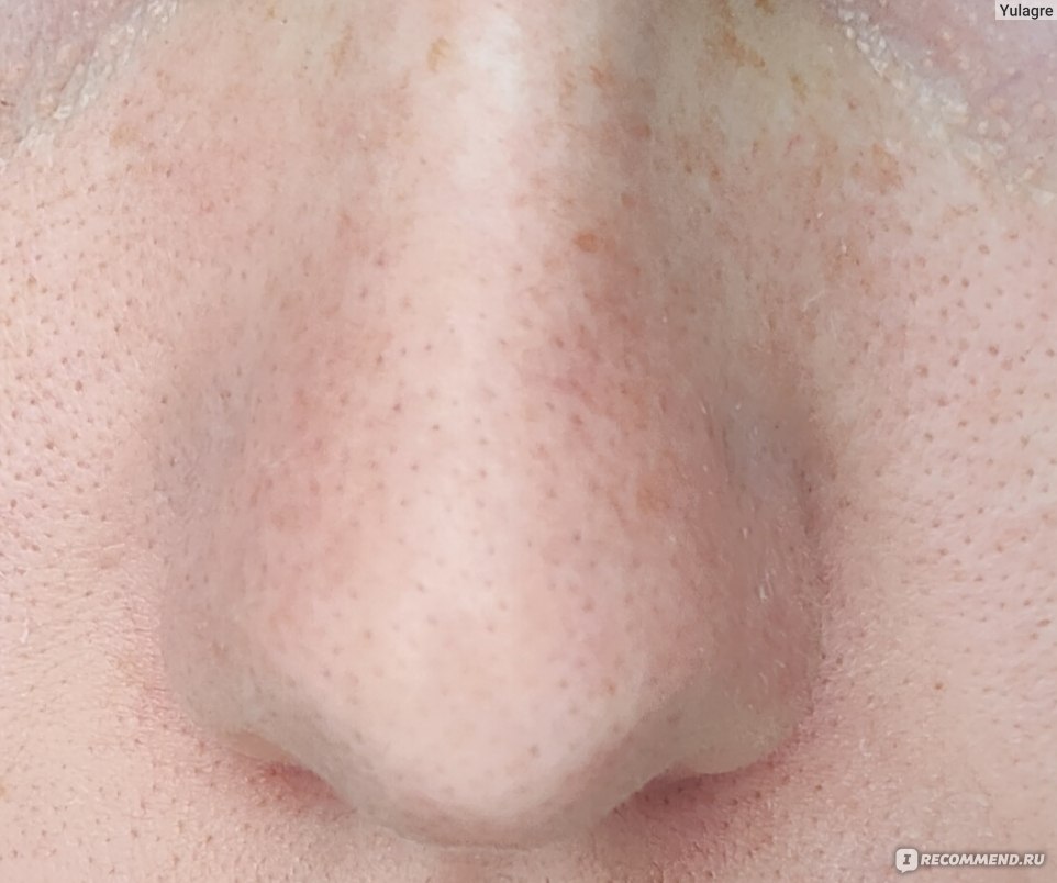 Очищающие полоски для носа Пропеллер Глубокая чистка пор фото