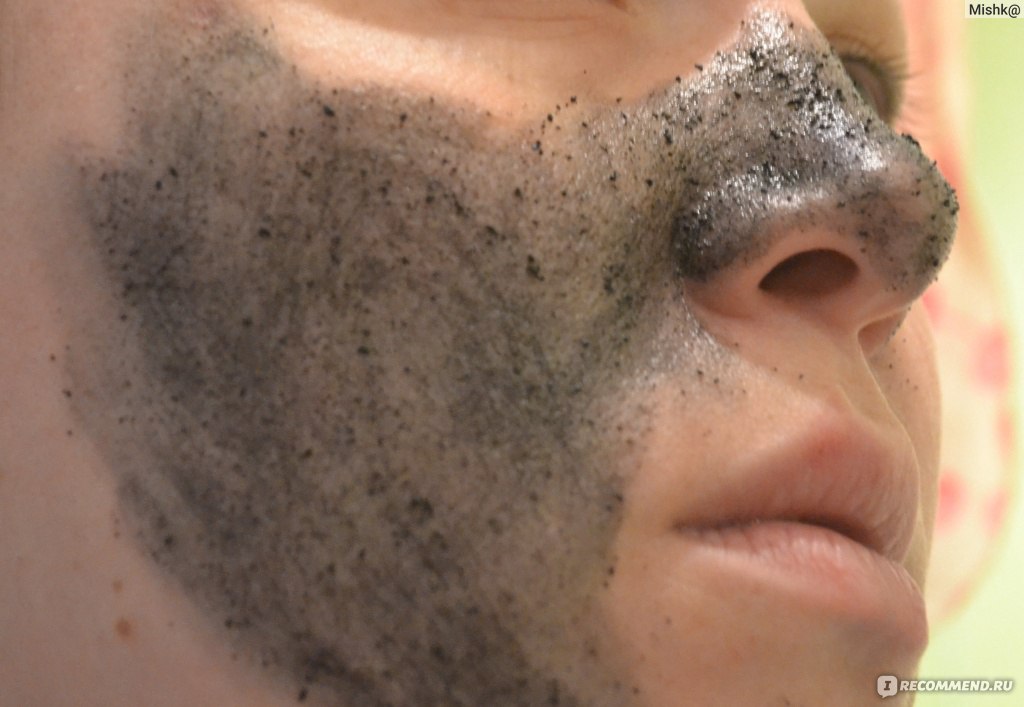 Чистка лица от прыщей и угрей вьетнам. Маска для распаривания кожи.