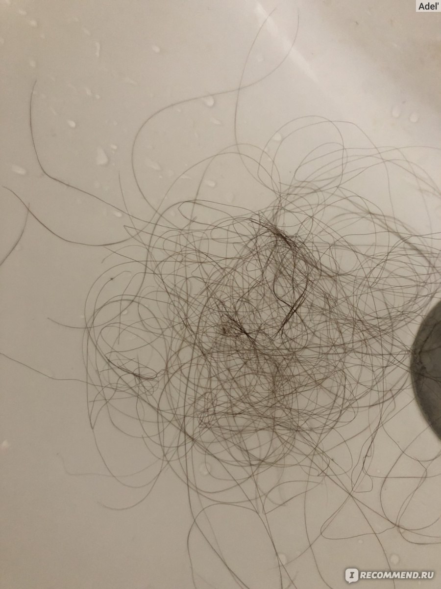 Норма выпадения волос в сутки. Норма выпадения волос. Норма выпадения волос при мытье. Норма выпадения волос в день у женщин. Выпадение волос при мытье головы.