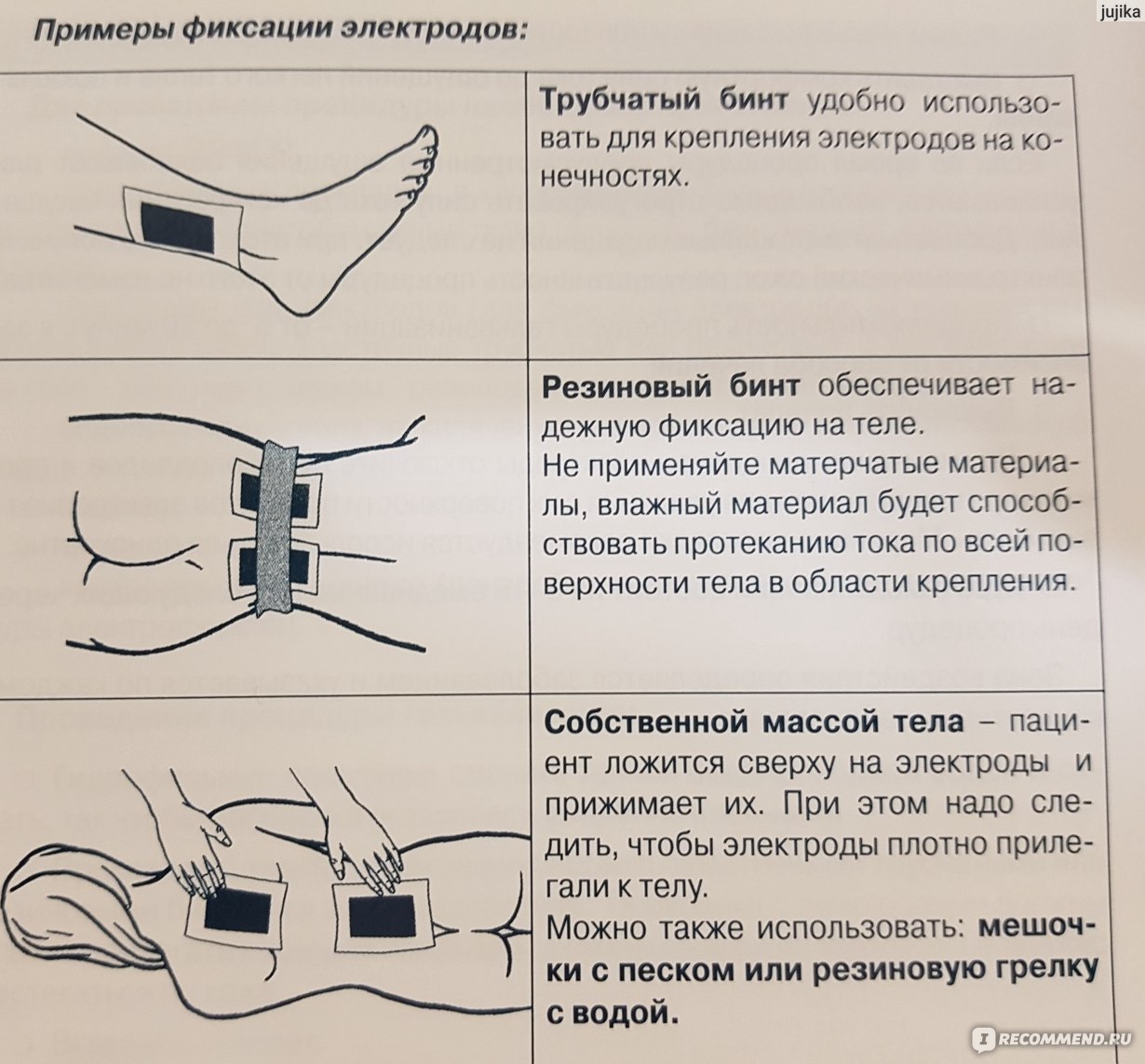 Электрофорез карипаин схема