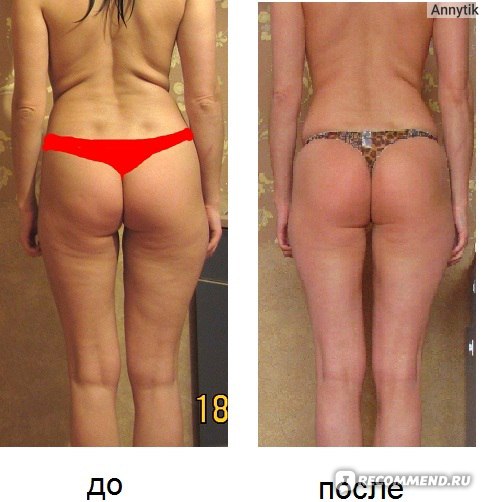 виброплатформа для похудения отзывы до и после женщины