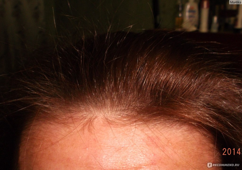 Шишки хмеля для волос до и после фото