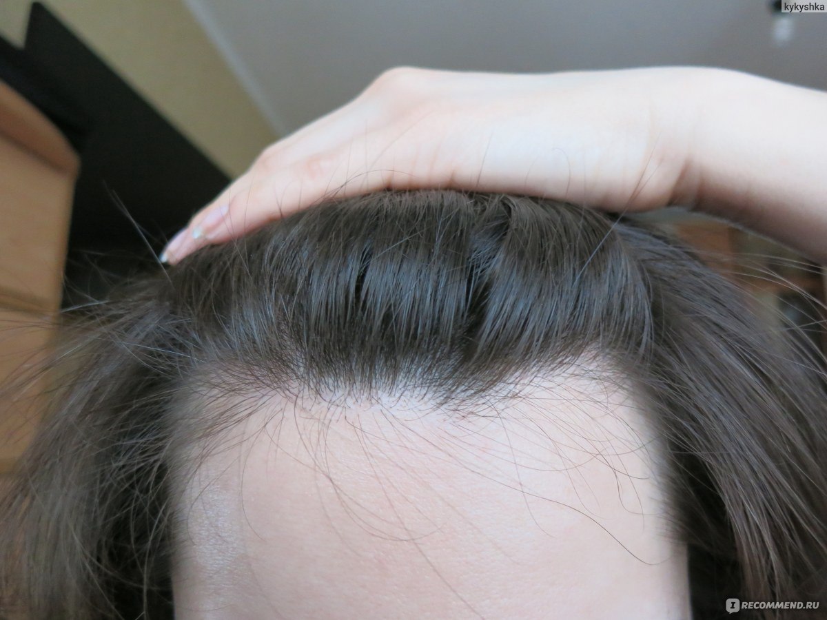 Как ускорить рост волос и увеличить густоту волос