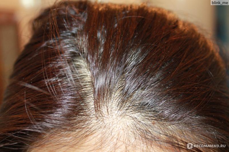 Можно ли смыть краску с волос кефиром, 4 эффективных рецепта
