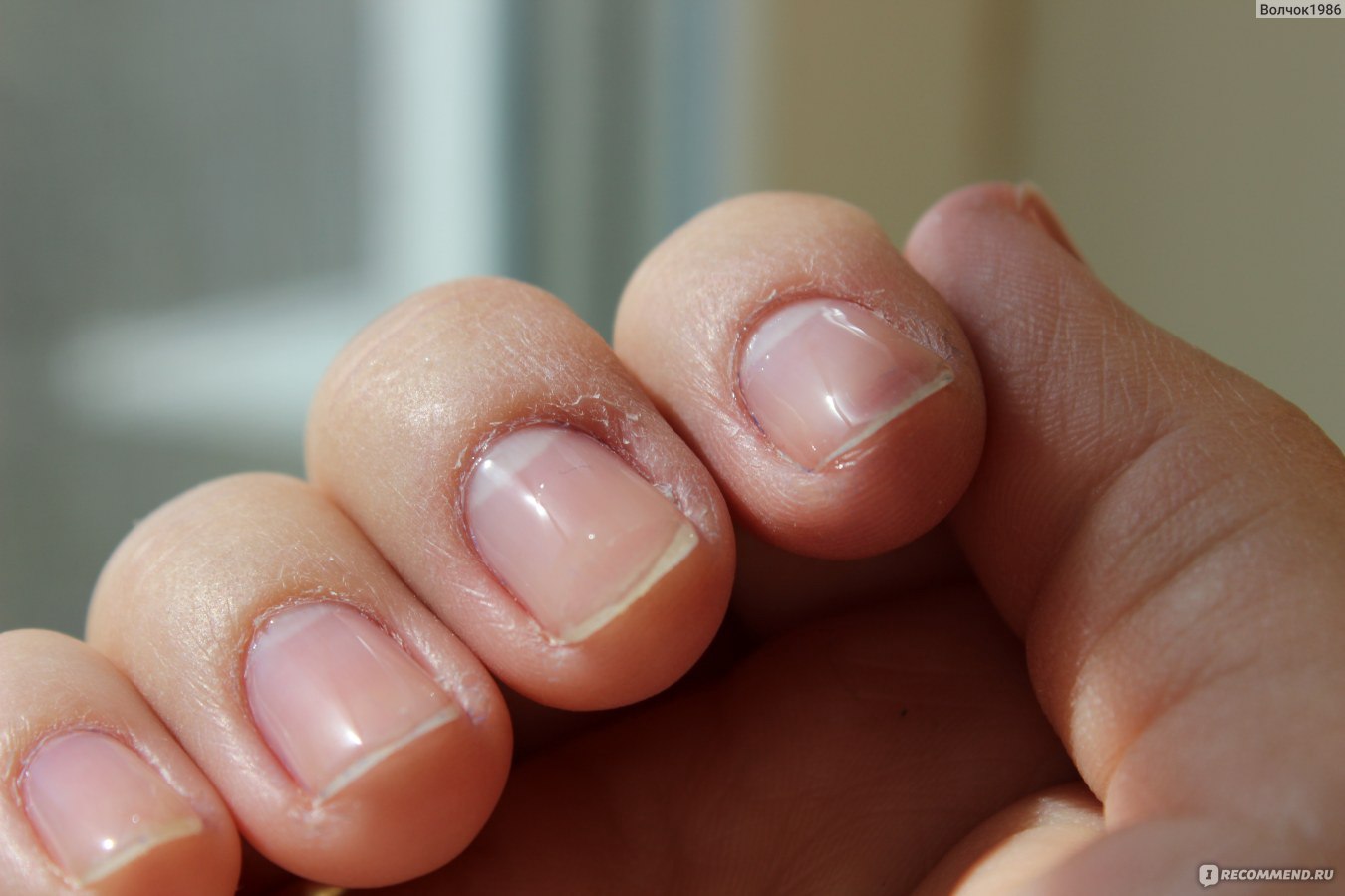Прозрачные царапины на ногтях
