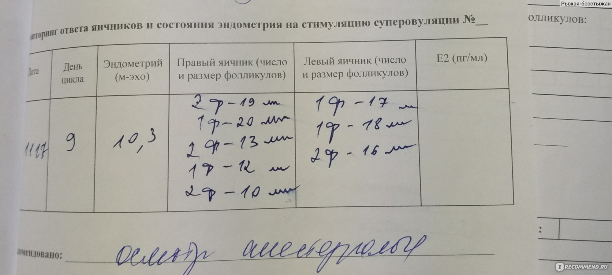 Экстракорпоральное оплодотворение (ЭКО) - «ЭКО по ОМС как оно есть.  Подготовка, подводные камни и немного лирики. Дневник протокола по дням.  Гиперстимуляция тяжёлой степени или долгие полтора месяца в стационаре.  Результат.» | отзывы