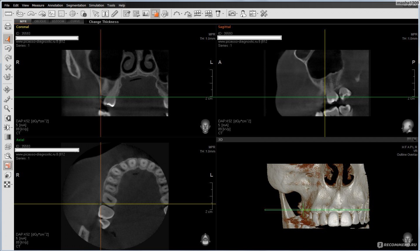 Пикассо кт. Компьютерная томография зубов Пикассо. Кт зубов 3д Пикассо. Центр Пикассо снимок кт. 3д снимок зубов Пикассо.