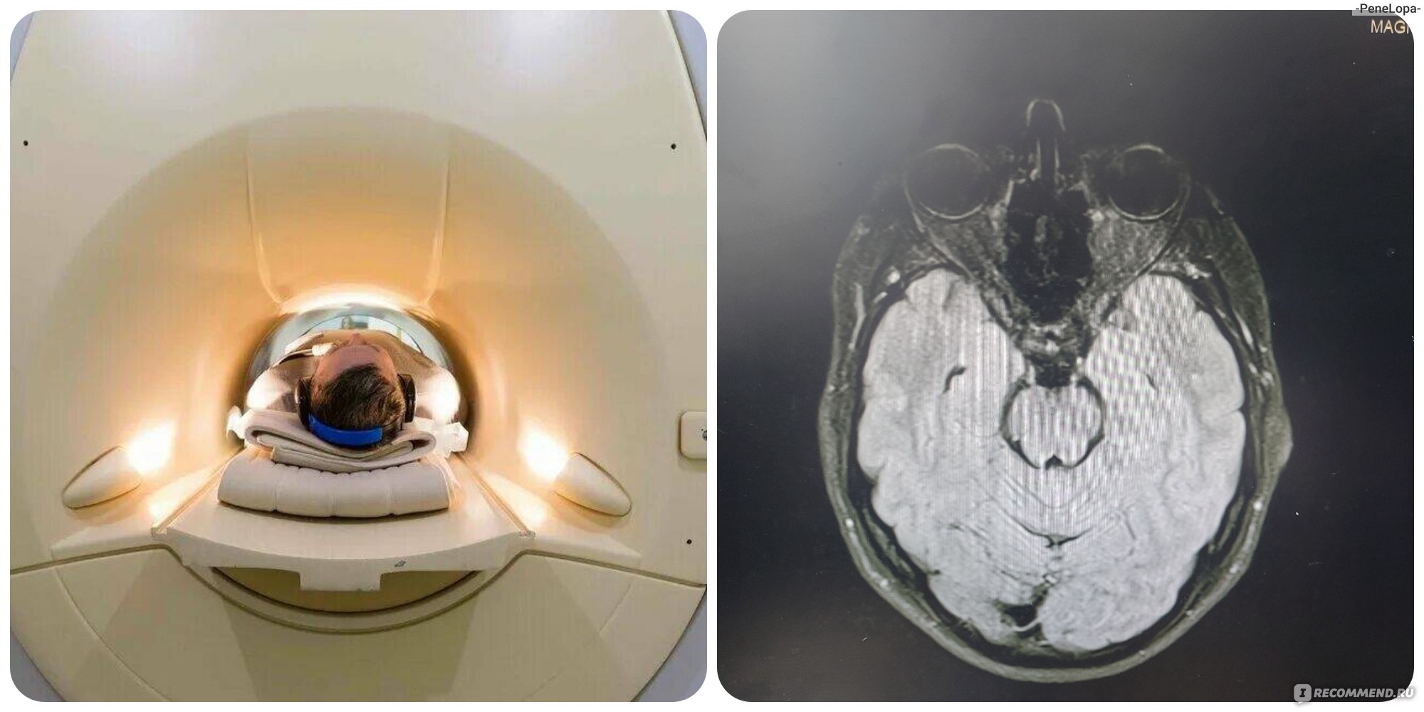 Магнитно-резонансная томография (МРТ) головного мозга - «Моё неудачное МРТ.  Процедура, на которую я больше не подпишусь, отправьте меня лучше зонд  глотать. МРТ мозга по сосудистой программе, что нужно учесть.» | отзывы