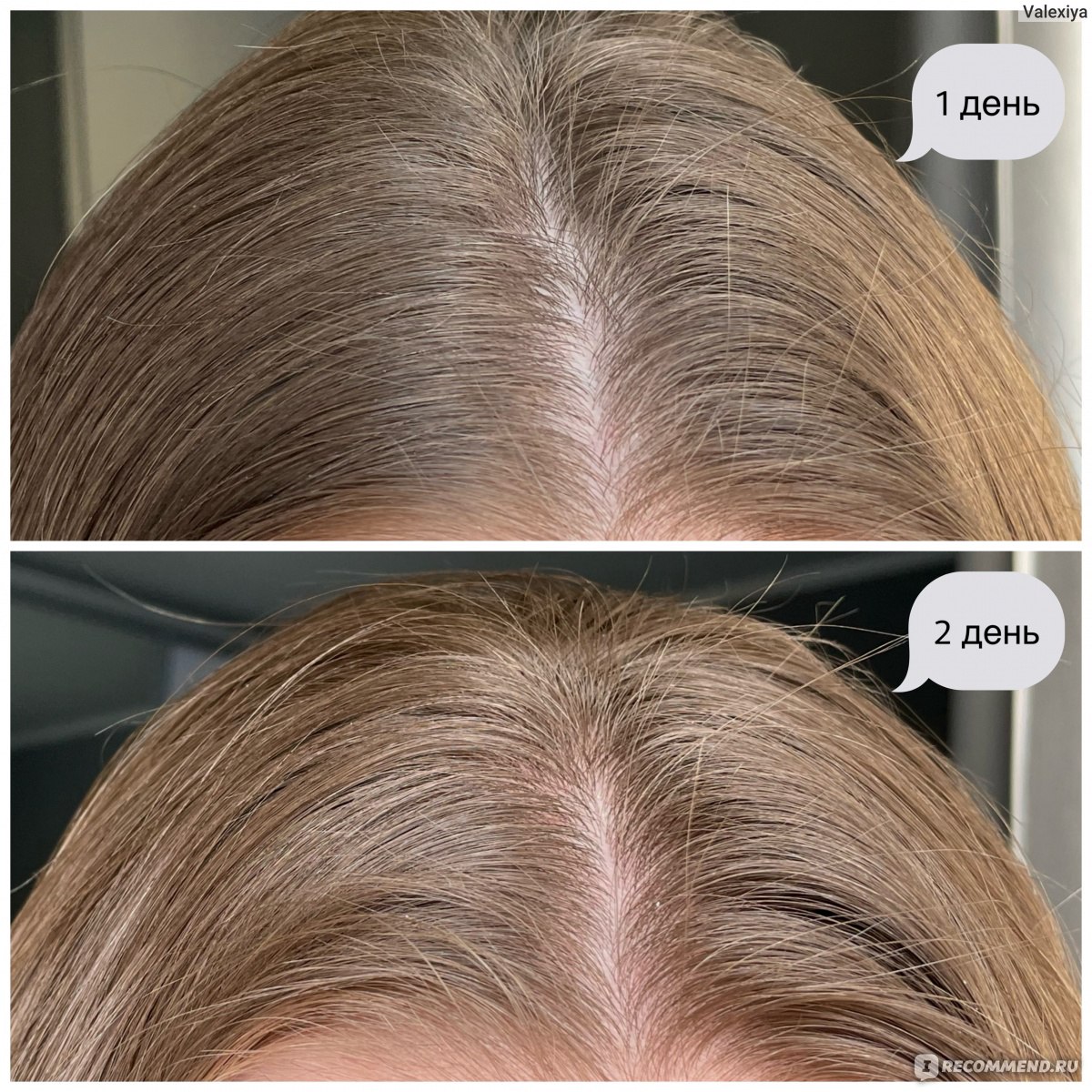 Шампунь L'Oreal Professionnel ABSOLUT REPAIR для восстановления поврежденных волос Gold Quinoa + Protein фото