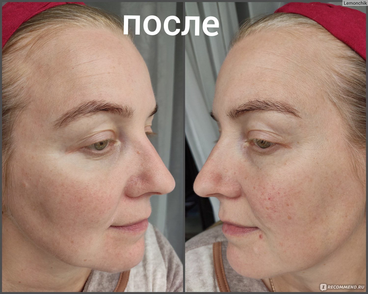 Hydrating primer before after