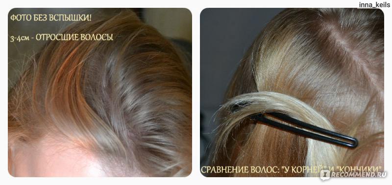 Комплекс от выпадения волос Sim Sensitive System 4  (терапевтическая маска "О", био-ботанический шампунь, био-ботаническая сыворотка)  фото
