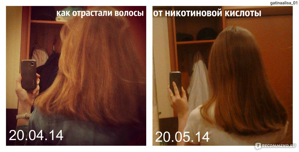 Как я отрастила длинные волосы до и после