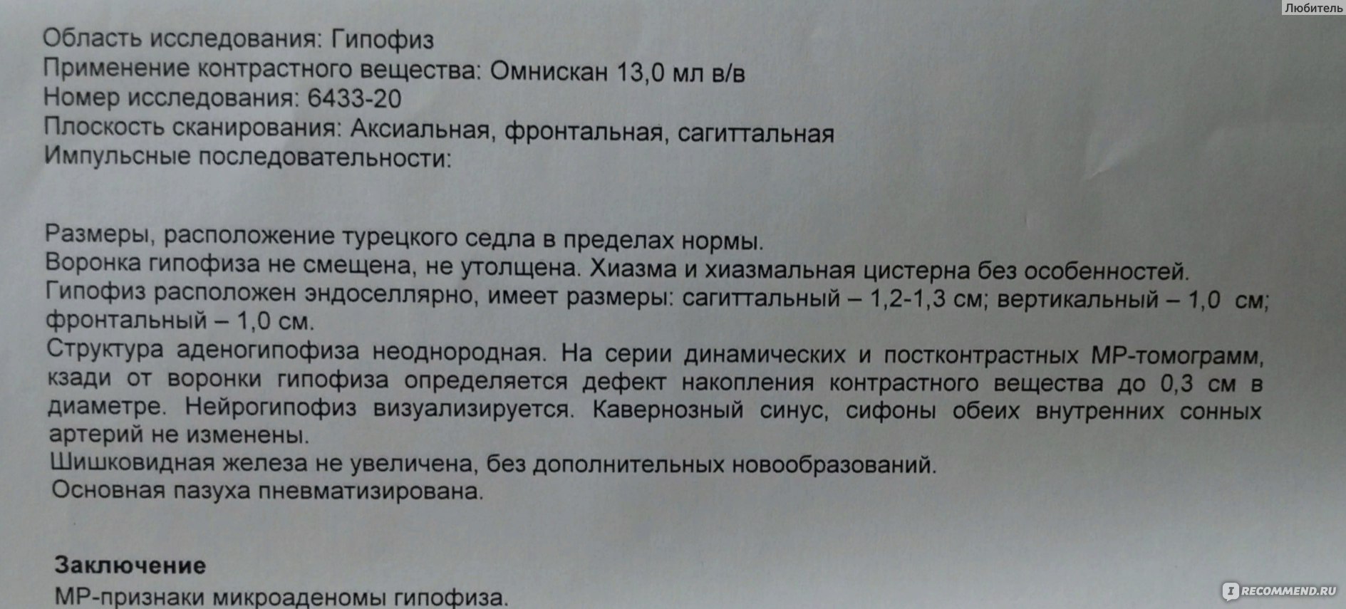 Пролактин, микроаденома гипофиза, беременность и достинекс — 6 ответов | форум Babyblog