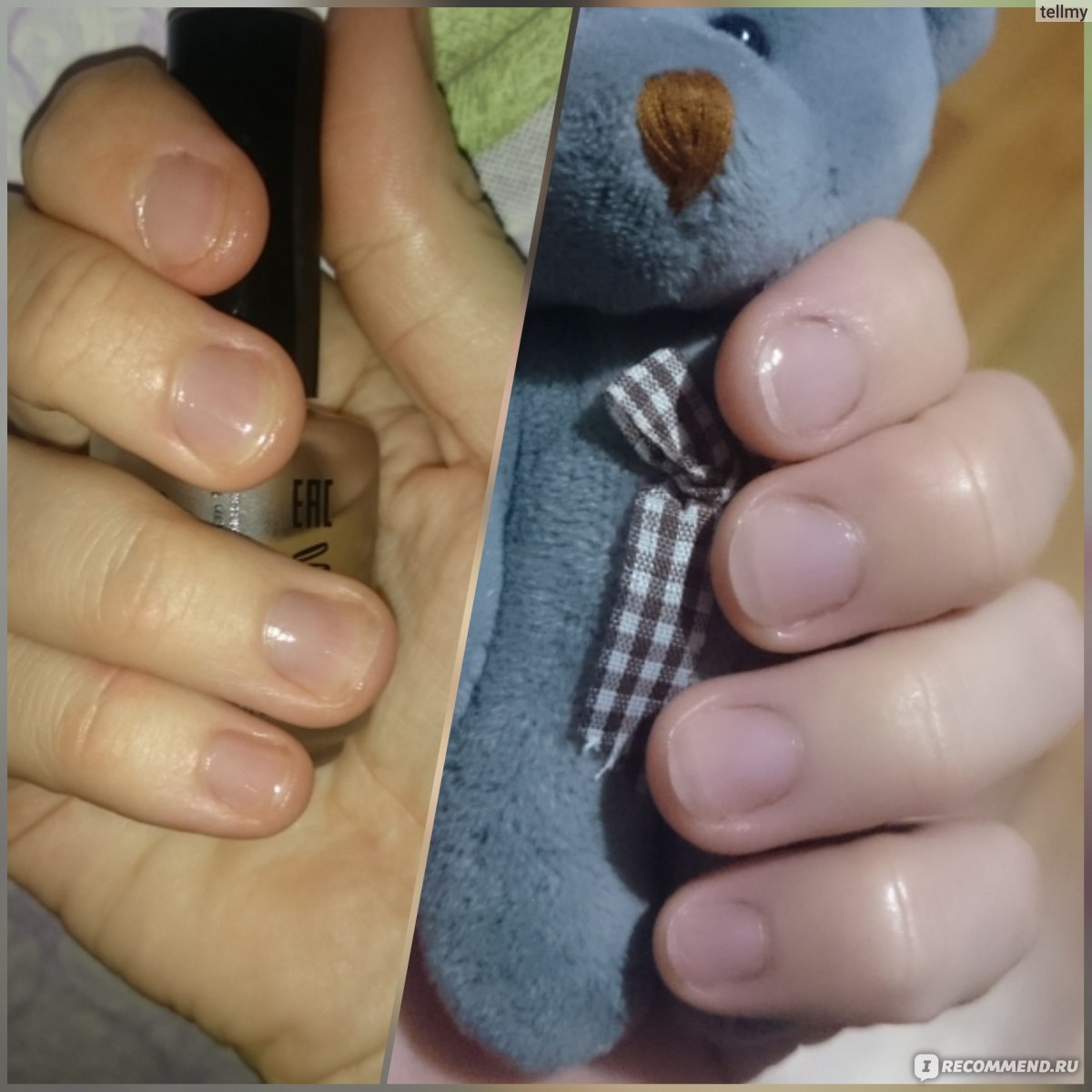 Отрастила ногти до и после