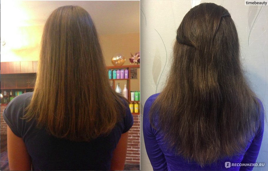 Мезо для волос до и после фото