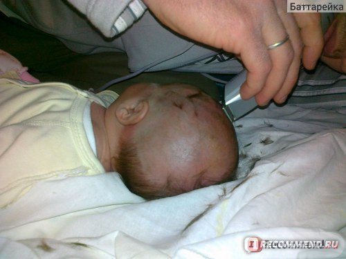 Шелушение кожи у новорожденных — 2 ответов | форум Babyblog