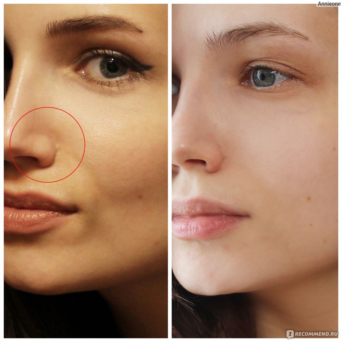 Сыворотка для лица L'Oreal Paris Revitalift с чистым ретинолом от ...