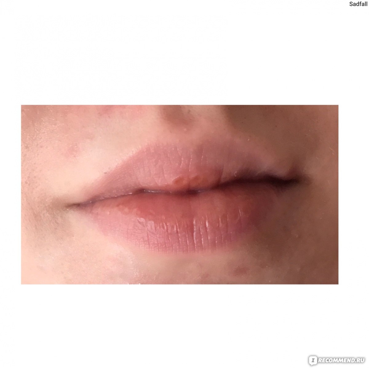 Бальзам для губ BABE Lip repairing cream фото
