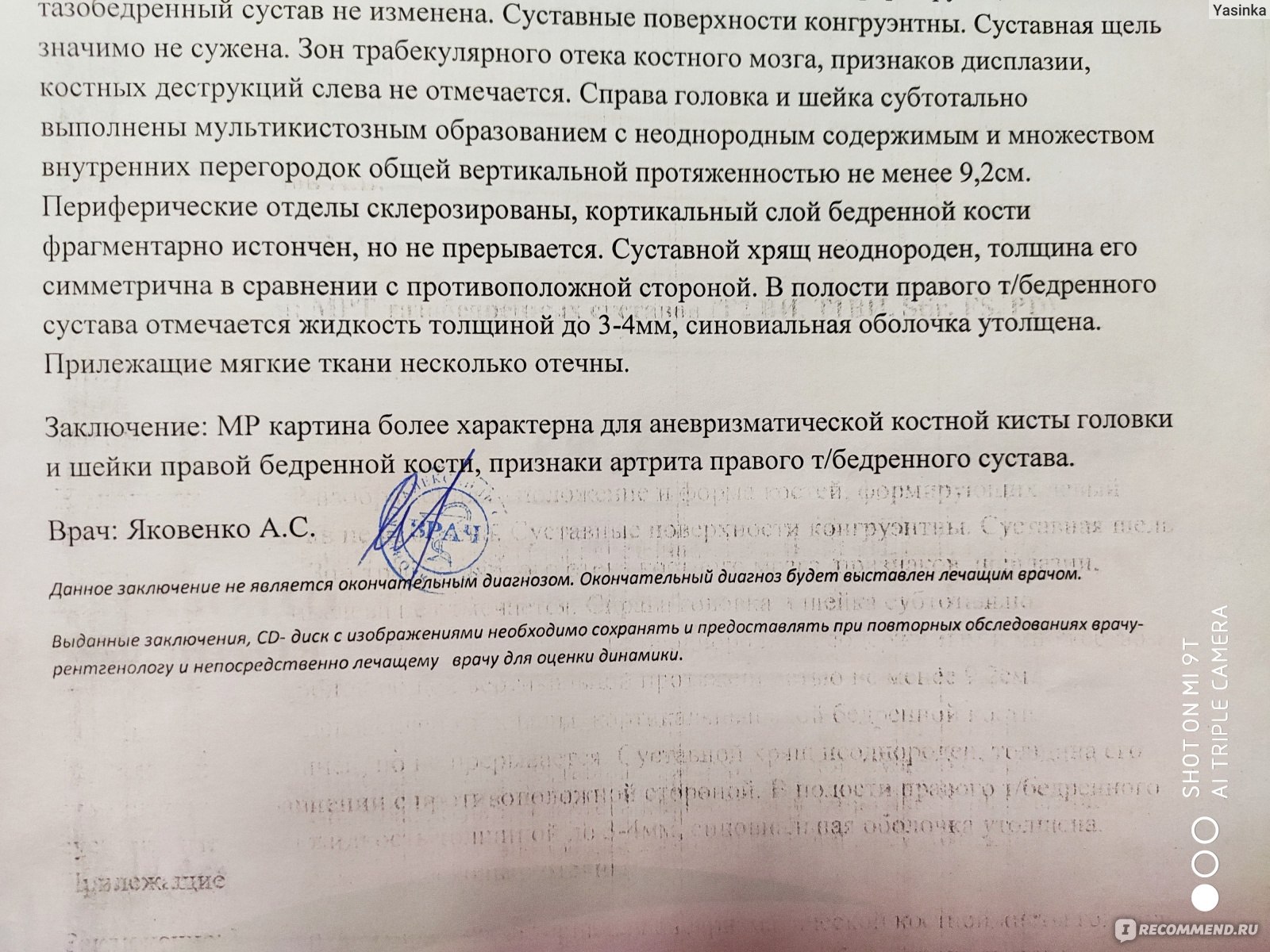 Эндопротезирование тазобедренного сустава - «Много боли, «брак» в  эндопротезировании. Пол года в больницах с открытой раной. Что нас спасло в  итоге.» | отзывы