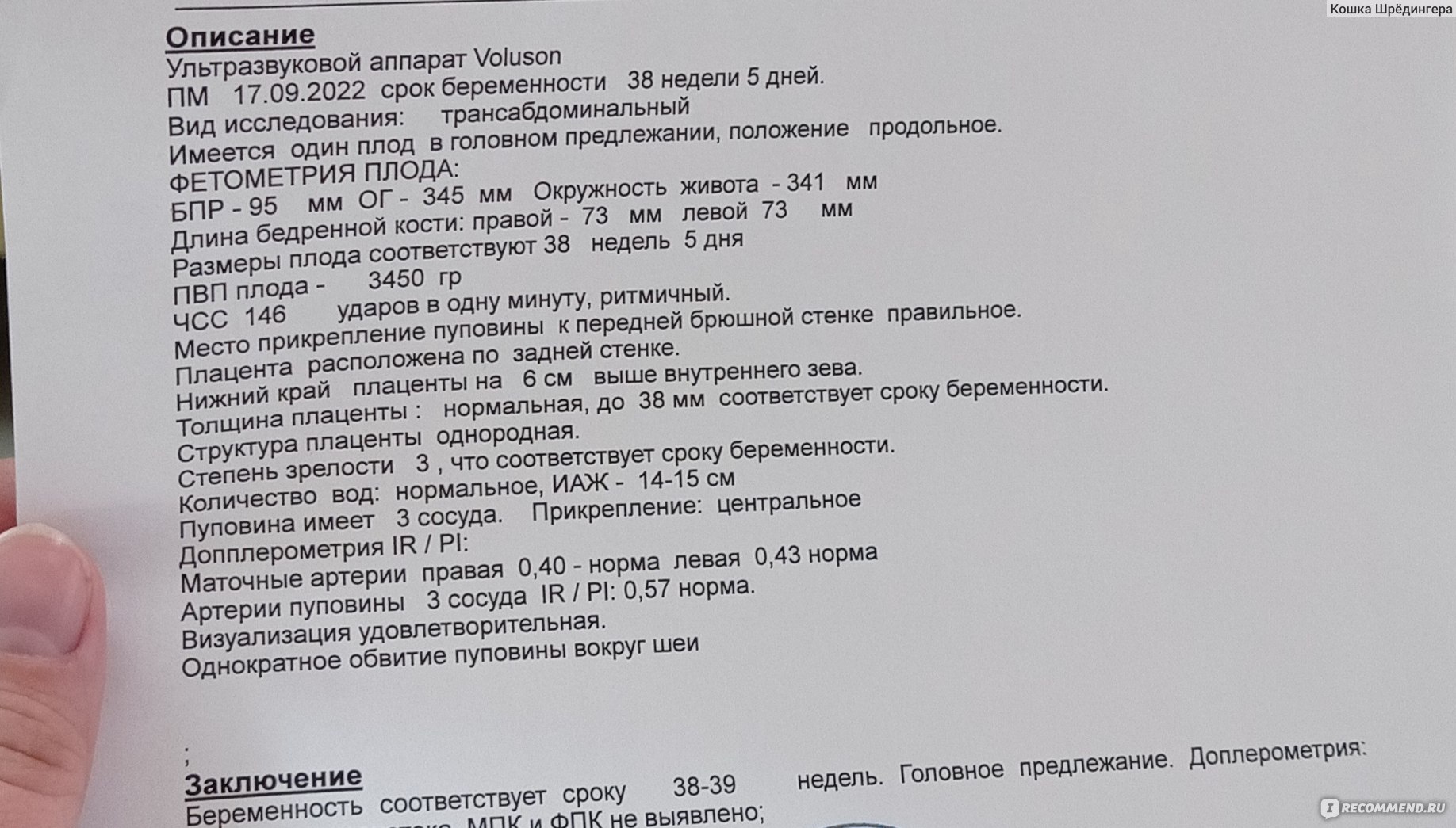 Естественные роды - «Мои [не]идеальные роды. ОМС, окситоцин, эпидуральная  анестезия, эпизиотомия, но оно однозначного того стоило. Список вещей: что  пригодилось в роддоме, а что не очень» | отзывы