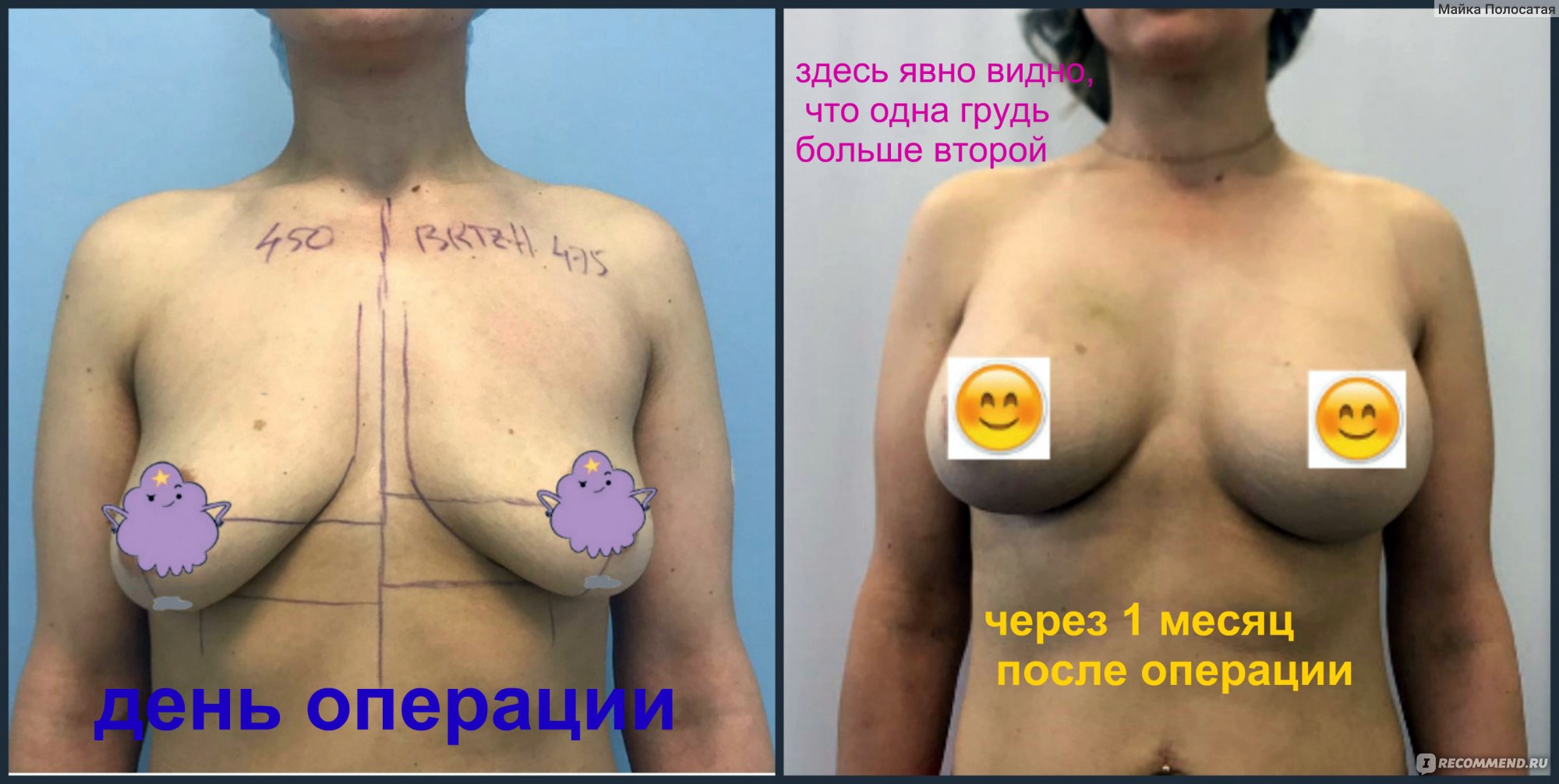 груди разных размеров у девочки подростка фото 66