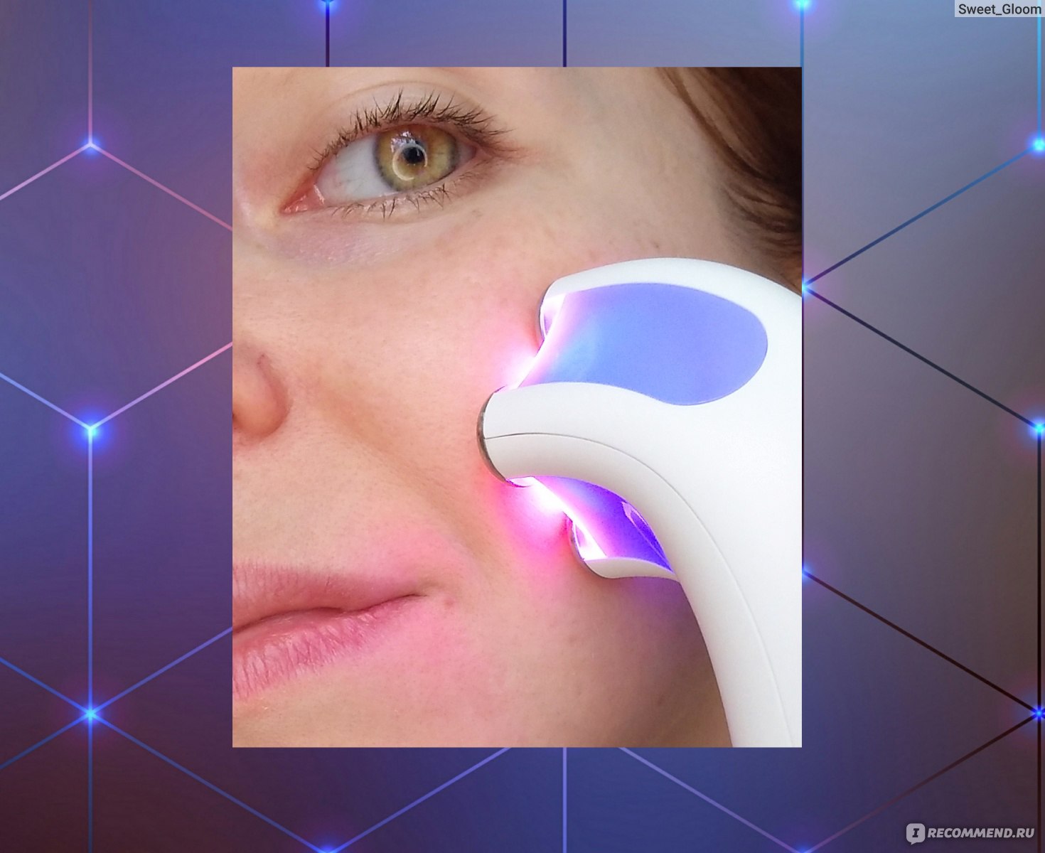 Аппарат для косметологических процедур D’EVI EMS LED Light Therapy Device фото