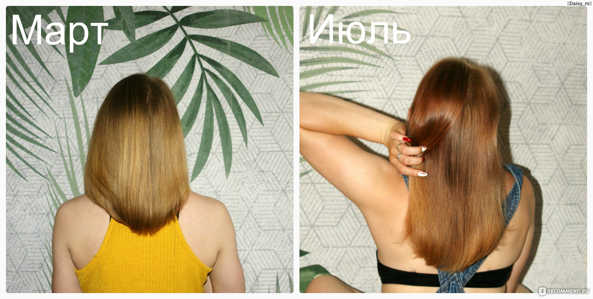 Никотиновая кислота для волос результаты фото до и после