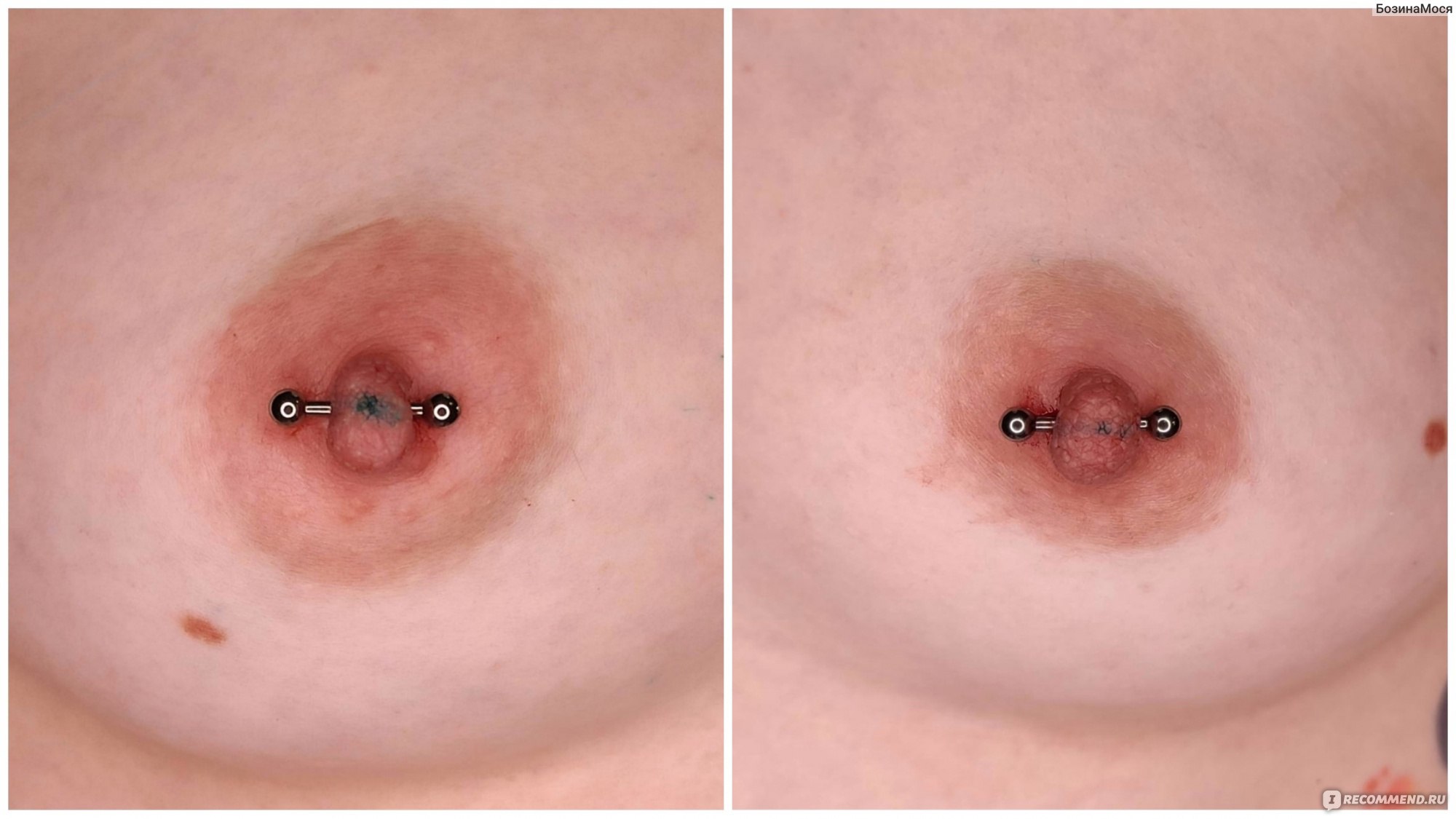 воспаление сосков на груди женщин фото 37