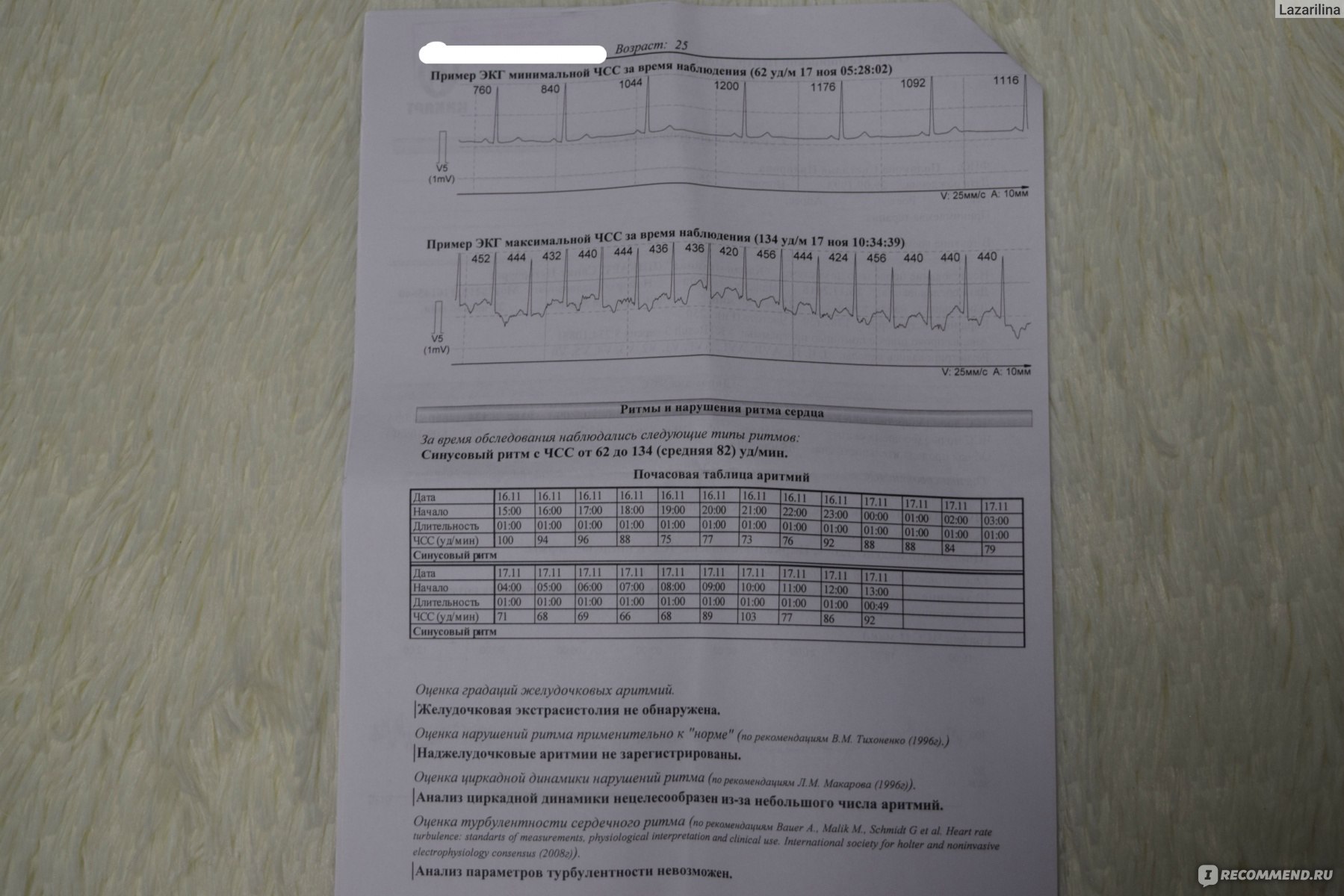 Холтеровское мониторирование ЭКГ - «Мой опыт Холтерского монтирования,  процесс установки, ощущение во время носки, сложности, цена. Зачем мне это  понадобилось в 25 лет?» | отзывы