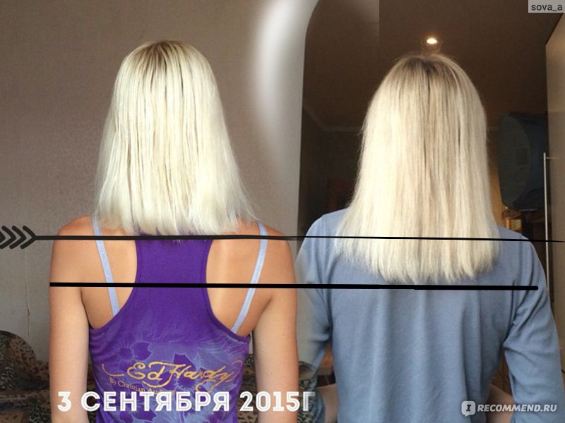 Рост волос за год до и после фото