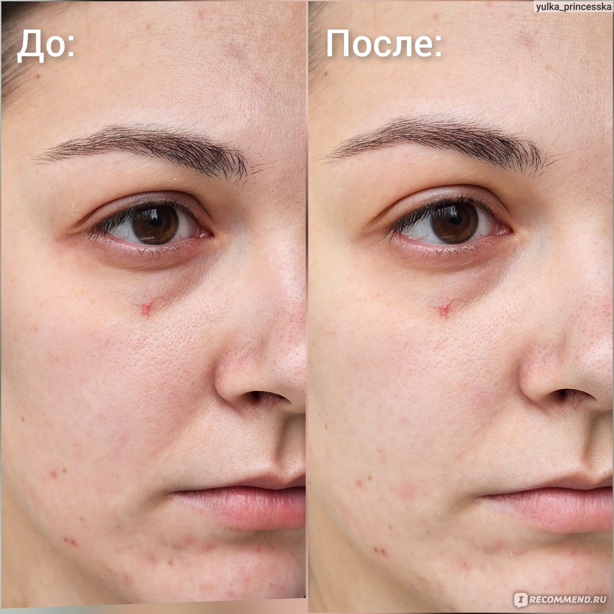 Очищающий гель для лица Мастерская Олеси Мустаевой Sensitive фото
