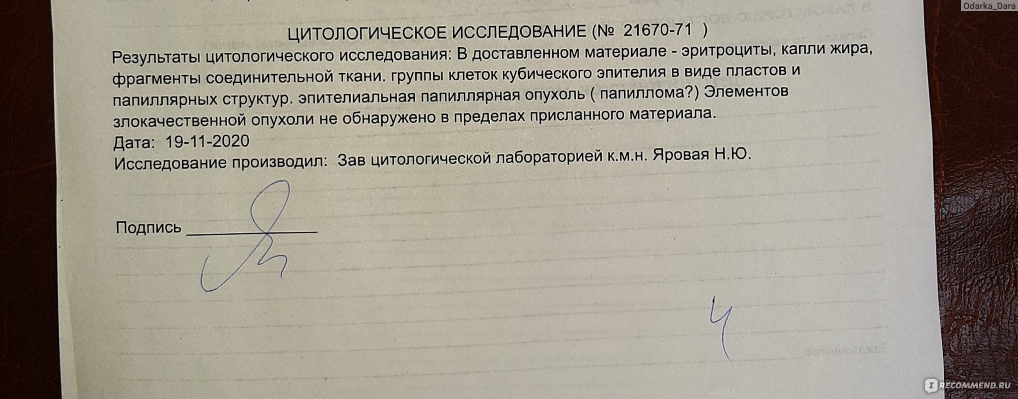 Пункция молочной железы - «В моем случае пункция оказалась решающей  процедурой для назначения операции. Онкология? Множественные фиброаденомы,  кисты, папиллома. Отзыв обновлен 27.12.2020» | отзывы