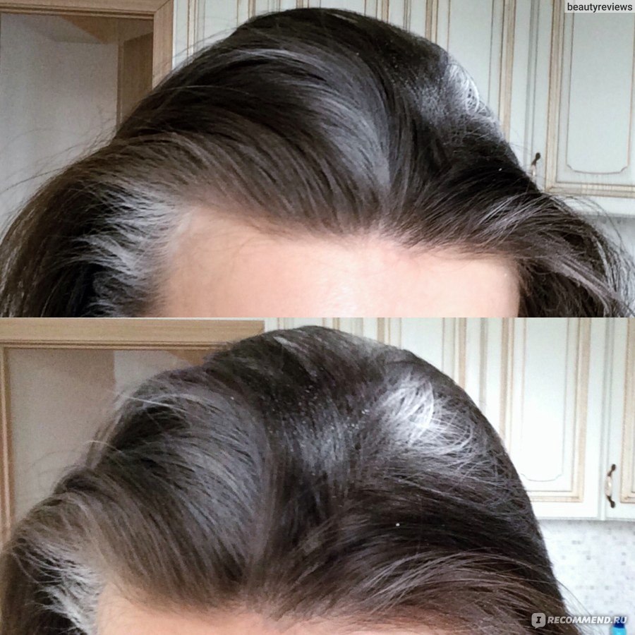 Волосы после сухого шампуня. Сухой шампунь до и после. Сухой шампунь для волос до и после. Сухой шампунь эффект до и после. Сухой шампунь результат до и после.