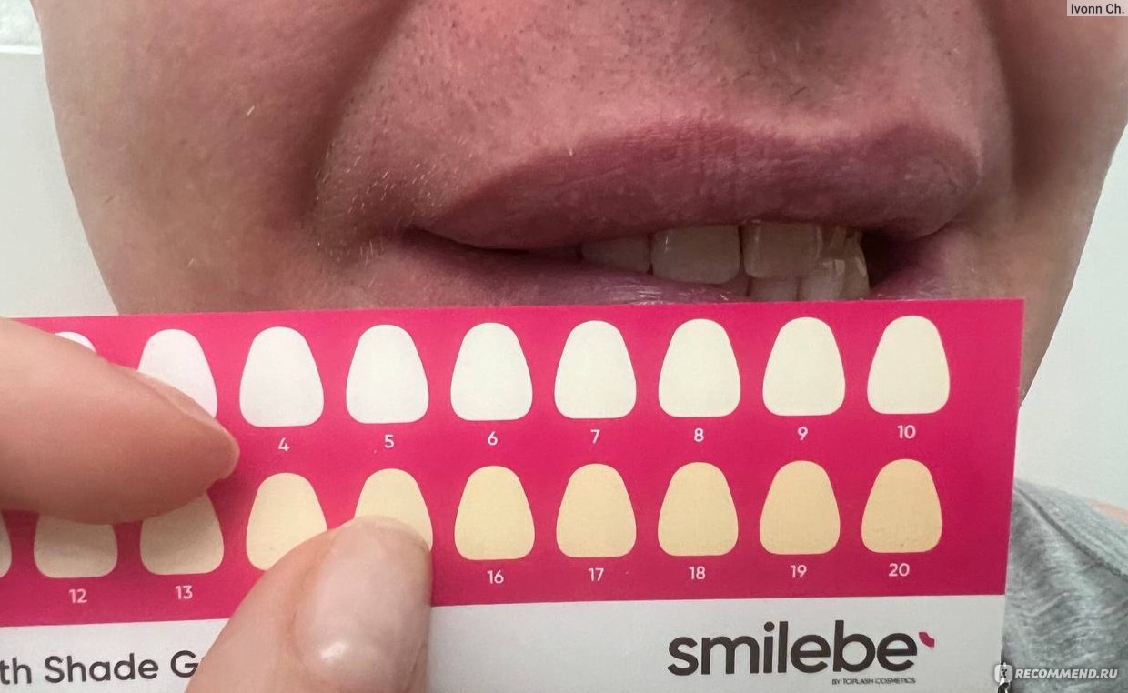 Отбеливающие полоски для зубов Smilebe Gentle - «Бережное отбеливание эмали  от стойкого налета всего за семь дней.» | отзывы