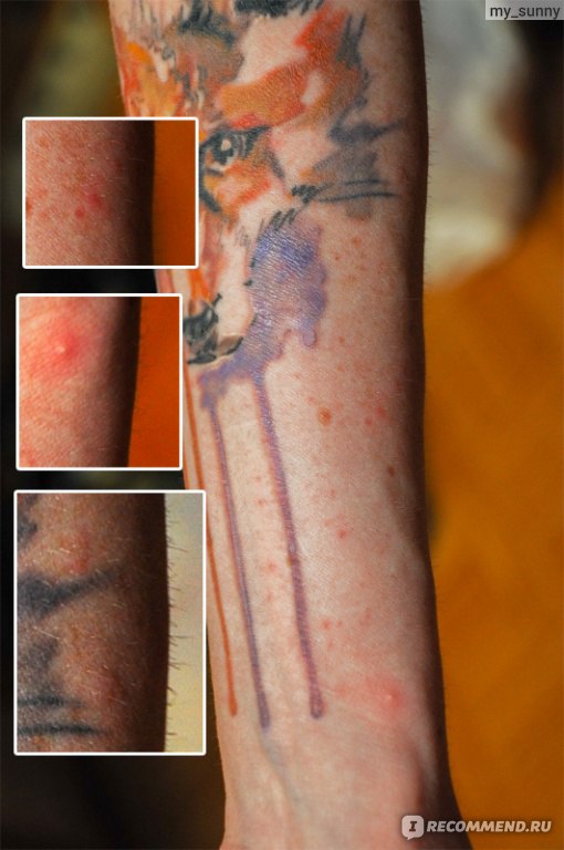 Метилурациловая мазь на свежую татуировку