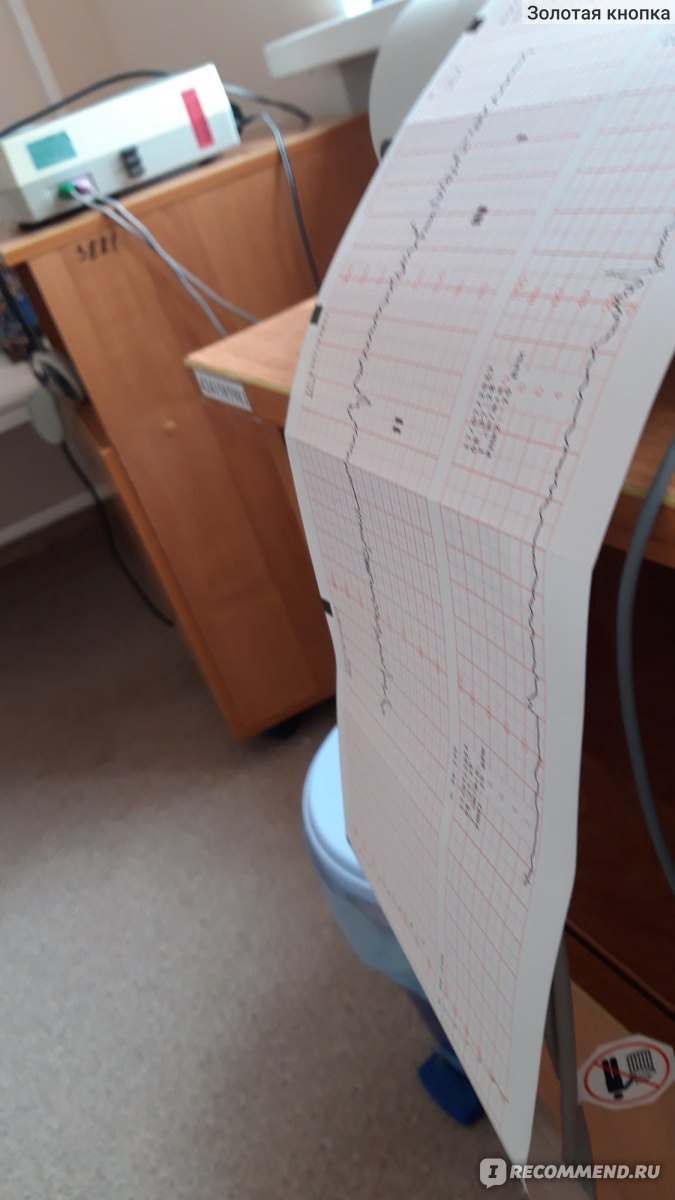 Кардиотокография (КТГ) - «Надо ли ходить на КТГ? Сколько лежать? 2  шевеления за 30 минут - это плохо? Почему не надо принимать во внимание все  слова врачей? И почему считаю, что аппарат