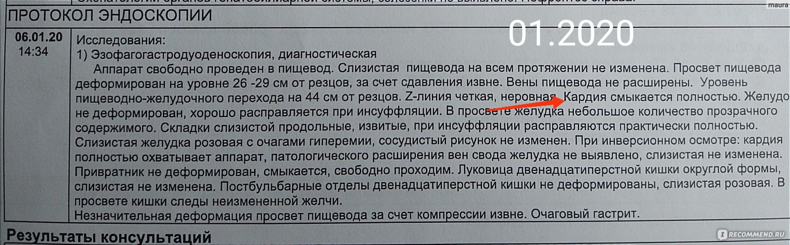 Диета при гастроэзофагеальной рефлюксной болезни (ГЭРБ) - «Сидела 1,5 года!  Примеры блюд и рецепты. Я вылечила ГЭРБ, когда бросила эту диету! Расскажу,  что помогло. Усиление симптомов, выпадение волос, как результат диеты. » |  отзывы