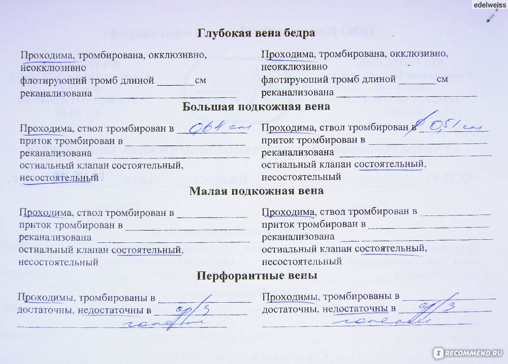 Узи вен нижних конечностей перед операцией. УЗИ вен нижних конечностей заключение норма. Протокол УЗИ сосудов нижних конечностей норма. УЗДГ вен нижних конечностей заключение. УЗИ вен нижних конечностей заключение УЗИ.