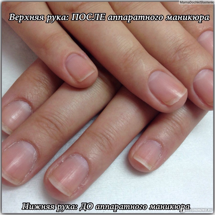 Ногти после аппаратного маникюра. Аппаратный маникюр фото до и после. Руки после аппаратного маникюра. Ногти после аппаратного маникюра до и после.