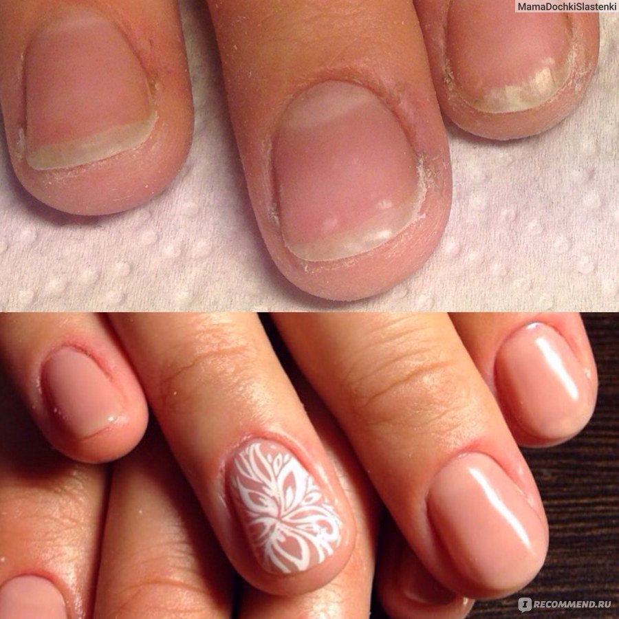 Ногти после аппаратного маникюра. Маникюр до и после.